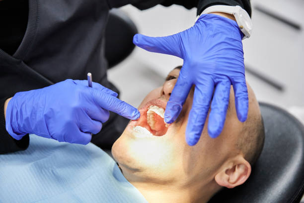 Best Broken Tooth Emergency  in Caddo, OK
